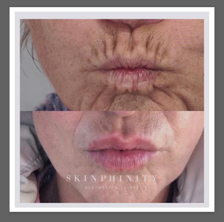 Skinphinity Skinphinity